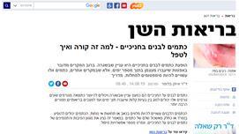 Ynet- בריאות- בריאות השן- כתמים לבנים בחניכיים - למה זה קורה ואיך לטפל ד"ר בלומר איתן